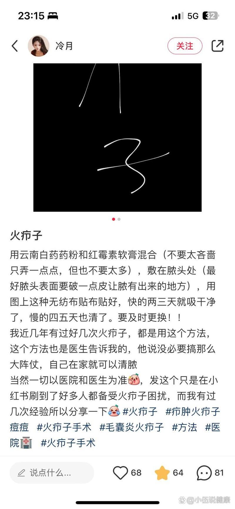 嗦牛子是什么梗？这个词是怎么火起来的？